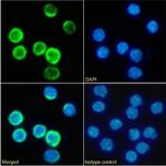 CD25 Chimeric Antibody in Immunocytochemistry (ICC/IF)