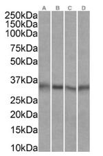 EpCAM (CD326) Chimeric Antibody in Western Blot (WB)