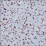 H3K9ac Antibody in Immunohistochemistry (Paraffin) (IHC (P))