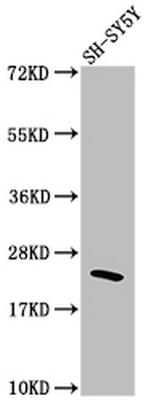 RhoA Antibody in Western Blot (WB)