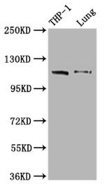 MDA5 Antibody in Western Blot (WB)