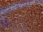 Survivin Antibody in Immunohistochemistry (Paraffin) (IHC (P))