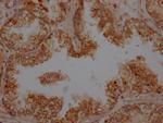 Urokinase Antibody in Immunohistochemistry (Paraffin) (IHC (P))