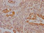 FBP1 Antibody in Immunohistochemistry (Paraffin) (IHC (P))