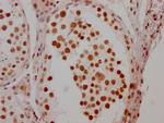 HSF1 Antibody in Immunohistochemistry (Paraffin) (IHC (P))