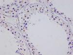 CRTC3 Antibody in Immunohistochemistry (Paraffin) (IHC (P))