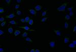 SERCA2 ATPase Antibody in Immunocytochemistry (ICC/IF)