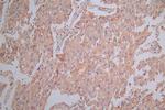 CRACC Antibody in Immunohistochemistry (Paraffin) (IHC (P))