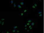 USP6 Antibody in Immunocytochemistry (ICC/IF)