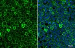 FCGR2B Antibody in Immunocytochemistry (ICC/IF)