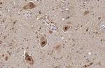 Aromatase Antibody in Immunohistochemistry (Paraffin) (IHC (P))