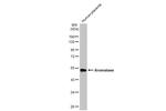 Aromatase Antibody in Western Blot (WB)