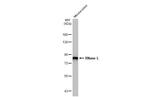 RNaseL Antibody in Western Blot (WB)