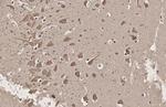 SERCA2 ATPase Antibody in Immunohistochemistry (Paraffin) (IHC (P))