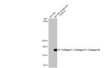 Collagen I/II/III Antibody in Western Blot (WB)