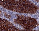 NAPSA Antibody in Immunohistochemistry (Paraffin) (IHC (P))