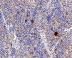 TGF beta-1 Antibody in Immunohistochemistry (Paraffin) (IHC (P))