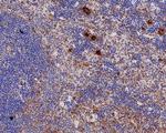 TGF beta-1 Antibody in Immunohistochemistry (Paraffin) (IHC (P))