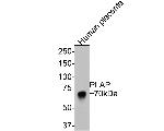 Placental Alkaline Phosphatase Antibody in Western Blot (WB)
