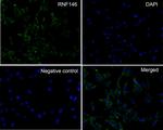 RNF146 Antibody in Immunocytochemistry (ICC/IF)