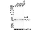 Arp2 Antibody in Western Blot (WB)