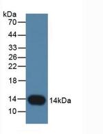 Cystatin B Antibody in Western Blot (WB)