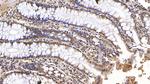 KPNA2 Antibody in Immunohistochemistry (Paraffin) (IHC (P))