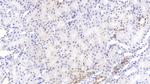 PCSK9 Antibody in Immunohistochemistry (Paraffin) (IHC (P))