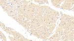 FABP4 Antibody in Immunohistochemistry (Paraffin) (IHC (P))