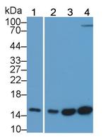 FABP4 Antibody in Western Blot (WB)