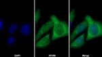 Cofilin Antibody in Immunocytochemistry (ICC/IF)