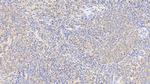 Cofilin Antibody in Immunohistochemistry (Paraffin) (IHC (P))