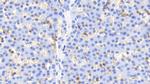 Cofilin Antibody in Immunohistochemistry (Paraffin) (IHC (P))