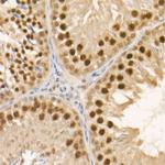 c-Abl Antibody in Immunohistochemistry (Paraffin) (IHC (P))