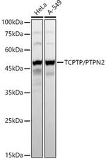PTPN2 Antibody in Western Blot (WB)