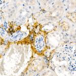 COL1A1 Antibody in Immunohistochemistry (Paraffin) (IHC (P))