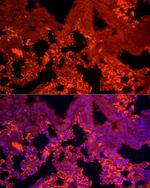 TGF beta-1 Antibody in Immunocytochemistry (ICC/IF)