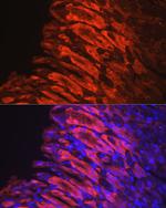 NQO1 Antibody in Immunocytochemistry (ICC/IF)