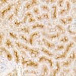 TGFBR2 Antibody in Immunohistochemistry (Paraffin) (IHC (P))