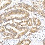 MMP3 Antibody in Immunohistochemistry (Paraffin) (IHC (P))