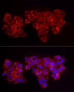 ACSL1 Antibody in Immunocytochemistry (ICC/IF)