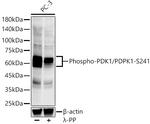 Phospho-PDPK1 (Ser241) Antibody in Western Blot (WB)