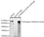 Phospho-RNA pol II CTD (Ser2, Ser5) Antibody in Immunoprecipitation (IP)