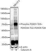 Phospho-FOXO1/FOXO3/FOXO4 (Thr24, Thr32, Thr28) Antibody in Western Blot (WB)