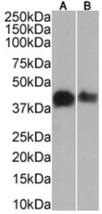 MAGEA3 Chimeric Antibody in Western Blot (WB)