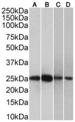 CRP Chimeric Antibody in Western Blot (WB)