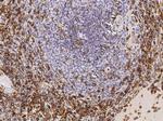 CD162 Antibody in Immunohistochemistry (Paraffin) (IHC (P))