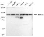 INPP4B Antibody in Western Blot (WB)