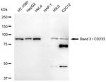 Band 3 Antibody in Western Blot (WB)