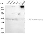E2F2 Antibody in Western Blot (WB)